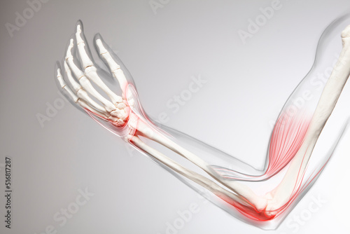 Human elbow pain, arm and bone 
