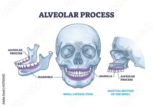 Alveolar process with anatomical head bone ridge for teeth outline diagram. Labeled educational scheme with chin maxilla and mandible parts vector illustration. Dental implant location on human skull.
