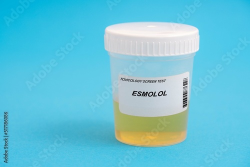 Esmolol. Esmolol toxicology screen urine tests for doping and drugs
