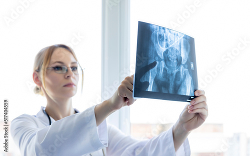The surgeon points his finger at the x-ray picture, about the need for surgery on the hip joint.