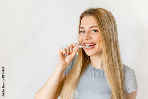 Dental care. Smiling woman with healthy teeth using removable clear braces aligner, orthodontic silicone trainer.