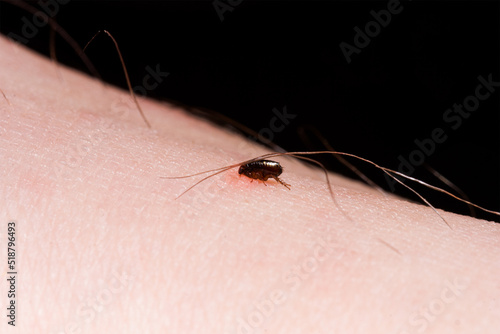 a flea bites a person sitting on his skin