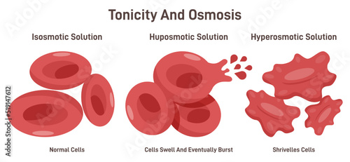 Tonicity as osmosis of the blood cells. Hypertonic, isotonic, hypotonic pressure