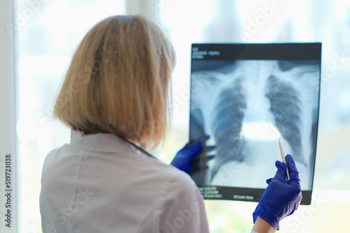 Doctor pulmonologist examining x-ray photograph of lungs