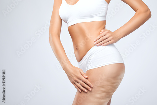 Fat woman with cellulite on her legs. Obese woman in white underwear.Overweight treatment.