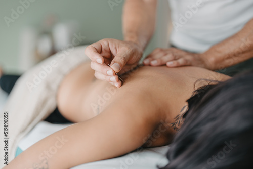 therapist about to stick an acupuncture needle