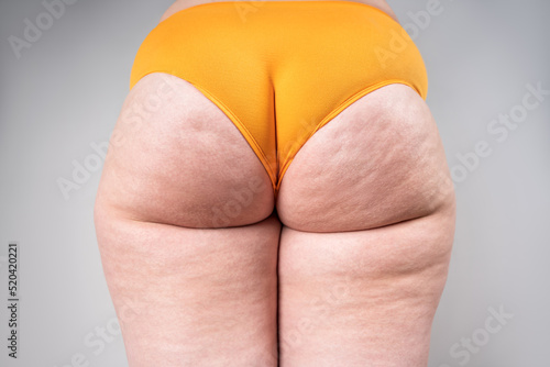 Overweight thigh, woman with fat hips and buttocks, obesity female body with cellulite on gray background