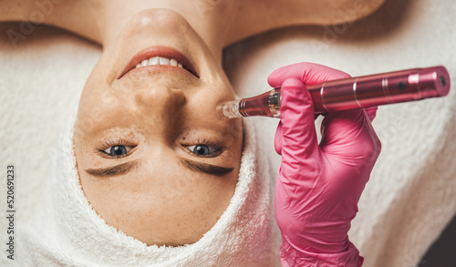 Cosmetologist's hand doing procedure of microneedling to the patient's smiling face. Aesthetic cosmetology, face care. Fractional Needle mesotherapy with