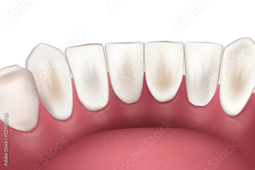 Realistic lower incisors teeth. 3d render of lower jaw. Dental anatomy. Medically accurate tooth. Orthodontic medical concept. Vector