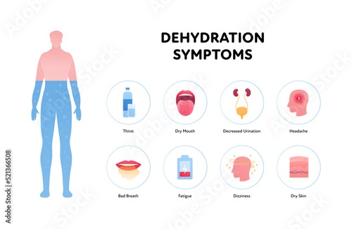 Dehydration symptoms infographic layout. Vector flat healthcare illustration. Human body silhouette water level. Thirst, dry mouth and skin, urination, headache, bad breath, fatigue, dizziness icon