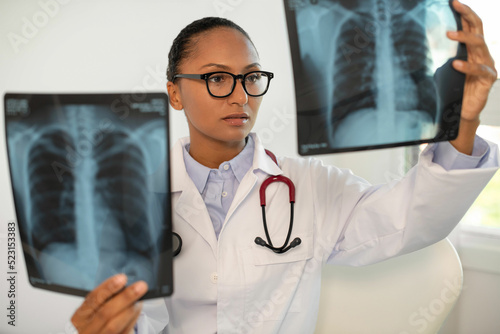 Portrait of confident pulmonologist examining x-ray of human chest. Young African American general practitioner looking at x-ray pictures of patients. Radiology research, pneumonia or asthma concept