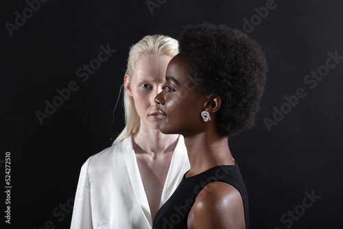 Caucasian albino girl and african american young woman portrait profile and full face on black background. Women friendship, love and relationships concept.