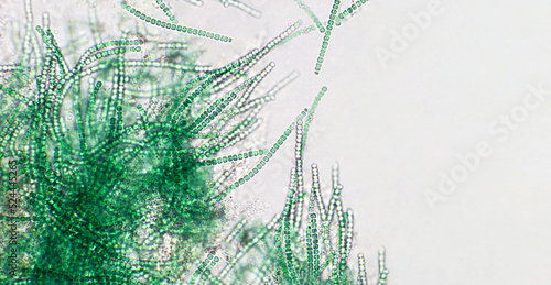 Blue green algae under microscopic view, cyanobacteria, gram-negative bacteria that obtain energy via photosynthesis