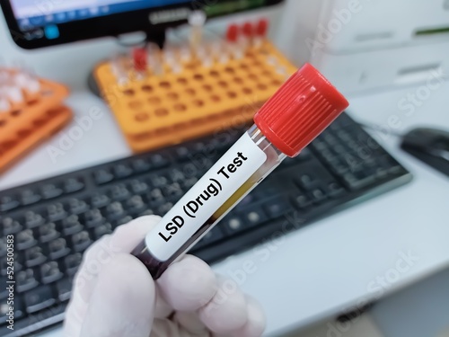Biochemist of Scientist holds blood sample for doping drugs test or LSD test in laboratory background.