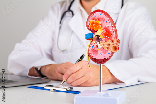 mockup kidney on work desk of doctor