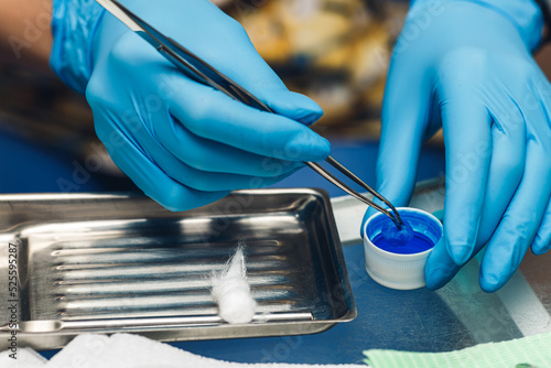 close-up dentist wetting cotton wool in blue liquid for fluoridation of teeth.