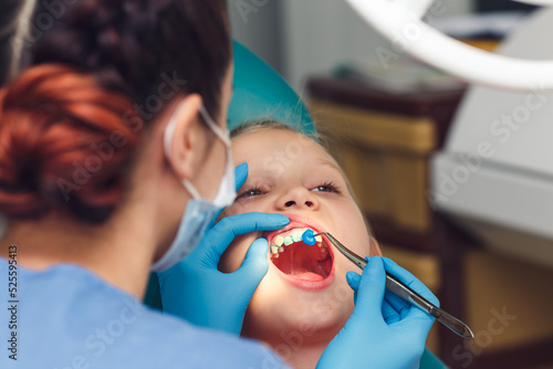 dentist fluoridates a child's teeth. Strengthening of tooth enamel.