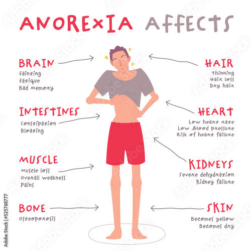 Eating disorder in men and boys. Anorexia nervosa.
