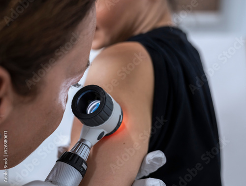 dermatologist examines birthmarks on the patient's skin with a dermatoscope. Dermatology, skin mole examining. looking for signs of melonoma or skin cancer.