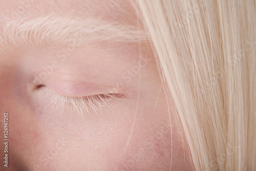 Close-up of albino girl having natural beauty with white eyebrows and eyelashes