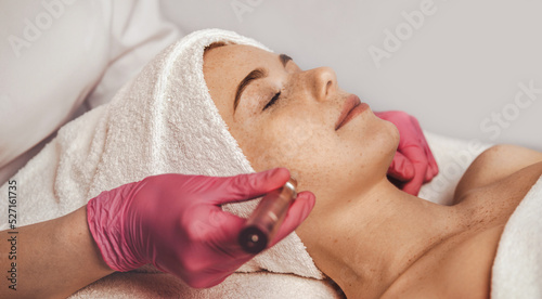Professional beautician using derma pen on woman's face skin, at spa salon. Cosmetology and professional skin care. Girl enjoying skin rejuvenation procedure