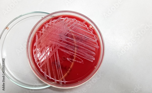 Blood agar medium growth of streptococcus, staphylococcus aureus, gram positive bacteria at medical microbiology laboratory.