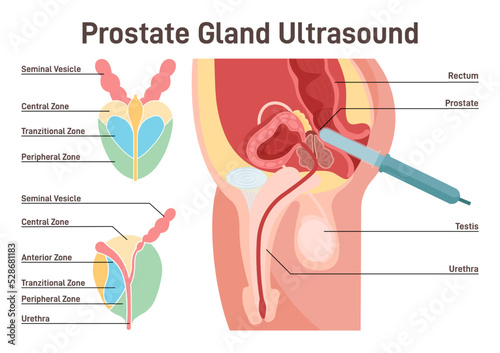 Prostate gland ultrasound. Rectal exam of prostate structure and condition.