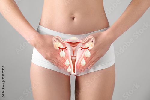 Woman holding hands on her belly and illustration of female reproductive system against light grey background, closeup. Vaginal yeast infection