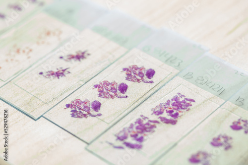 Stained tissue biopsy on glass slides in pathology laboratory