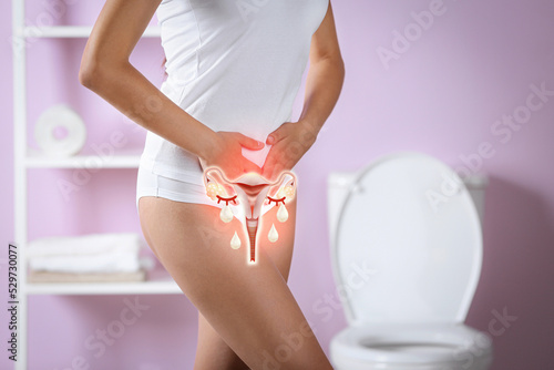 Woman holding hands on her belly and illustration of female reproductive system. Vaginal yeast infection