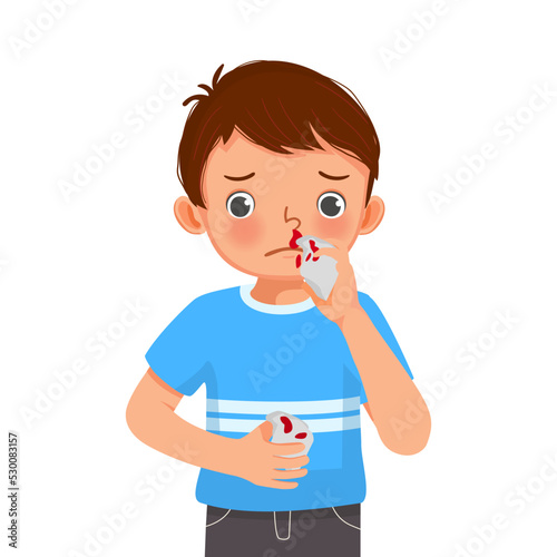 cute little boy wipe his bleeding nose with tissue paper