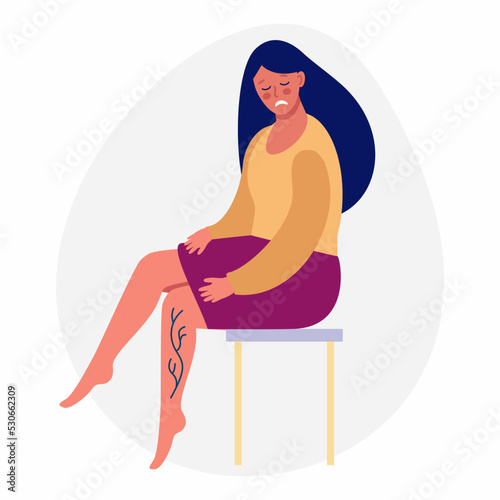 Sad girl with varicose veins. Illustration of a woman with leg pain.