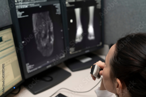 radiology doctor examines foot, ankle x-ray, mr image and reports with microphone looking computer screen, X-ray analysis room reading X-rays of a heel, toe and other parts of the body.