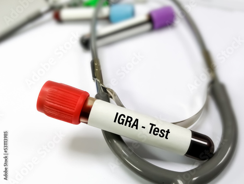 Blood sample for IGRA(interferon gamma release assay) test for diagnosis of Tuberculosis