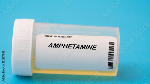 Amphetamine. Amphetamine toxicology screen urine tests for doping and drugs