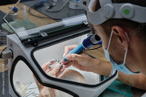 Dentist hand mills tooth crowns created on 3d printer for metal. Dental technician working with ceramic crowns in protective box at the laboratory.