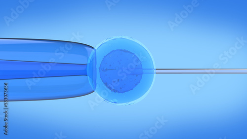 In vitro fertilization (IVF) is a process of fertilization where an egg is combined with sperm in vitro. Test tube baby in lab for pregnancy 