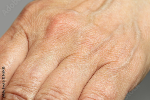 Closeup view of mature person with clean skin on hand