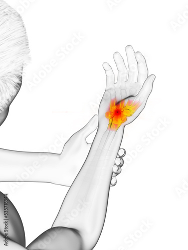 3d rendered medically accurate illustration of a man having a painful wrist
