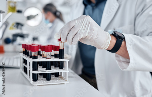 Scientist, science and dna blood sample test tube in pathology lab with gloves doing research and working on vaccine or medical investigation. Innovation, breakthrough and medicine with hands of man