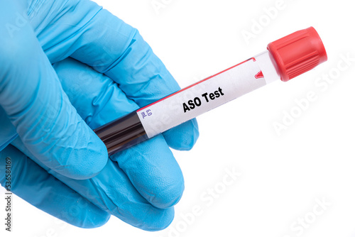 ASO Test Medical check up test tube with biological sample