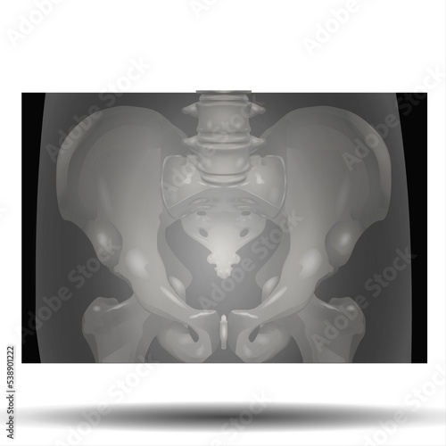 X-Ray of Pelvis - Fla source file available - Structure of the pelvis. Anatomical poster of human skeleton. Pelvic bones concept. Sacrum, Ischium, pubis and ilium. Coccyx and pubic symphysis in male.