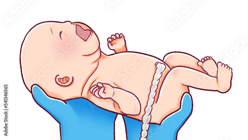 出産の瞬間のイラスト へその緒がついた赤ちゃん