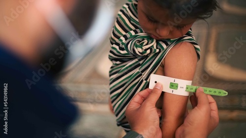 A doctor examines children's malnutrition inside a refugee camp. Malnutrition was measured using a mid-upper arm circumference belt. 