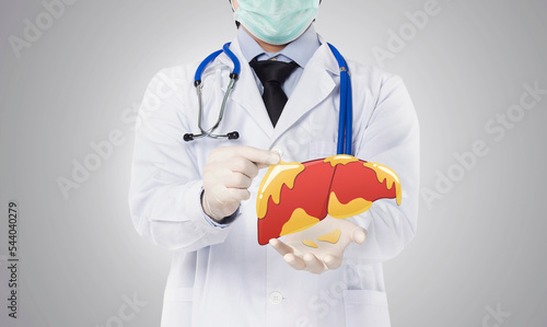 doctor showing fatty liver , liver disease