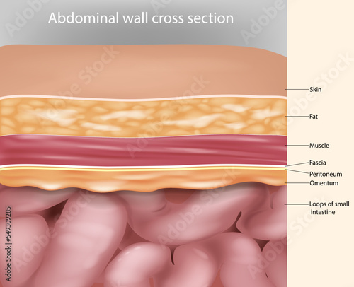 Abdominal wall cross section Anatomy. Abdominal wall layers Medical Illustration