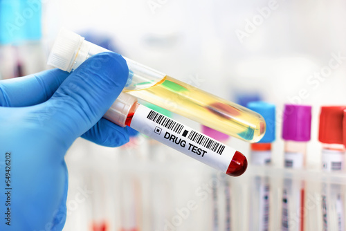 Hand doctor holding urine and blood tube test for analysis for doping or drugs. Doctor's hand with urinalysis and blood sample for drug test or alcohol in the laboratory