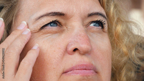 middle aged female's eye with drooping eyelid with patch for eyes. Ptosis is a drooping of the upper eyelid, lazy eye. Cosmetology and facial concept, first wrinkles