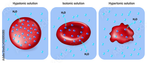 Hypotonic, Isotonic and Hypertonic solutions vector. Tonicity and osmosis.