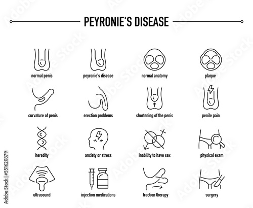Peyronie's Disease symptoms, diagnostic and treatment vector icon set. Line editable medical icons.